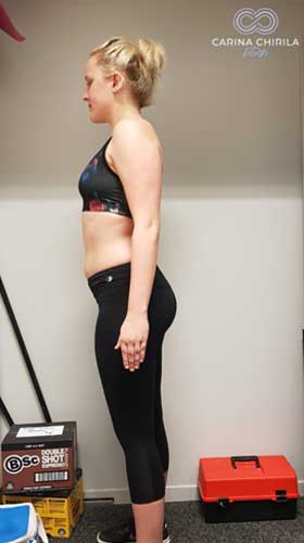Anastasia – Week 1 Side — before